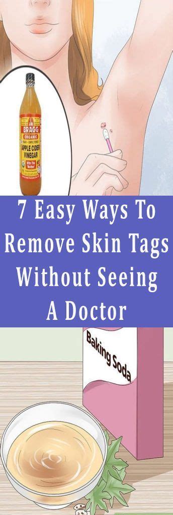 7 easy ways to remove skin tags without seeing a doctor health caplet