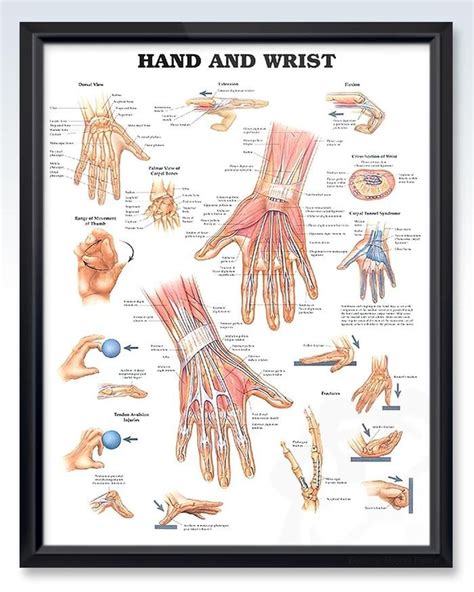 Hand And Wrist Chart 20x26 In 2020 Carpal Tunnel Medical Posters
