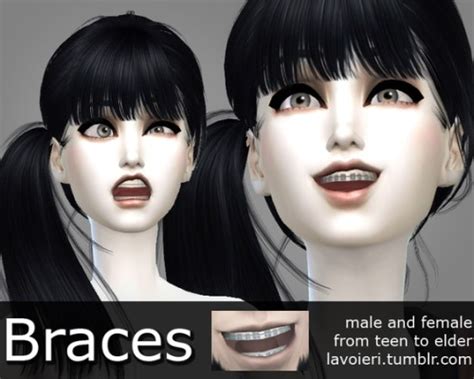 Braces Tagged Sims 4 Downloads