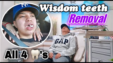 Getting My Wisdom Teeth Removed Vlog Horrible Experience Youtube