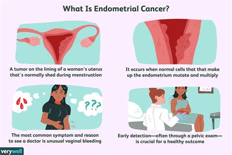 Endometrial Cancer Symptoms