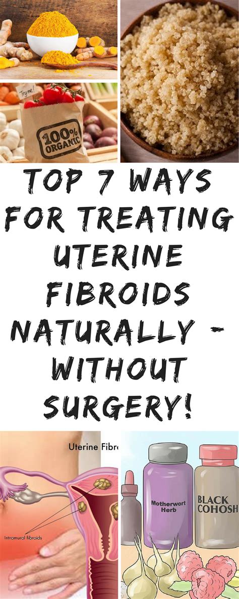 Top 7 Ways For Treating Fibroids Naturally Without Surgery Health