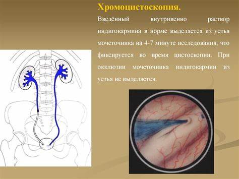 Пиелонефрит диета 7 Пиелонефрит - online presentation Пиелонефрит - online presentation Пиелонефрит диета 7