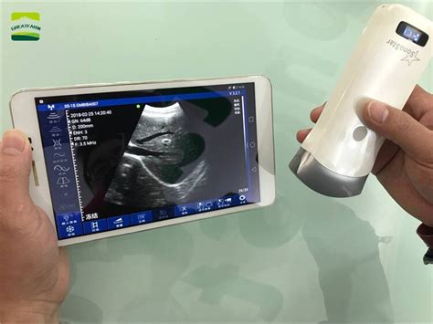 Wireless Veterinary Ultrasound Scanner Portable Pregnancy Test Handheld