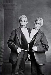 Image result for "Siamese twins," Chang and Eng Bunker,