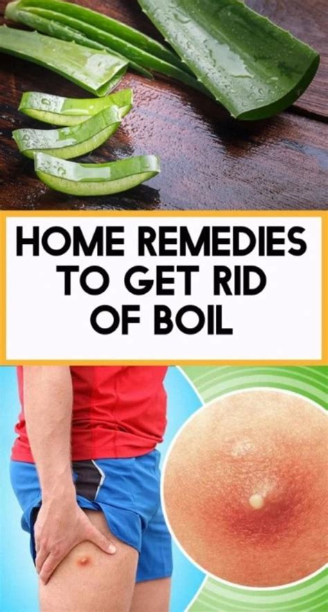 Home Remedies To Get Rid Of Boil Remedies Natural Remedies Health