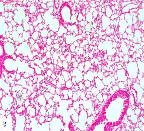 Photomicrograph Of Lung Section Stained By Hematoxylin And Eosin A
