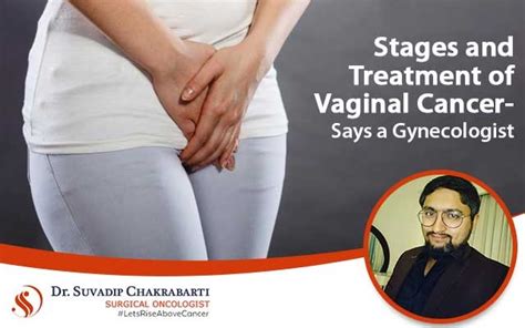 Stages And Treatment Of Vaginal Cancer Says A Gynae Oncologist