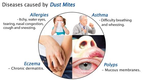 Do Air Purifiers Help With Dust Mites What You Need To Know