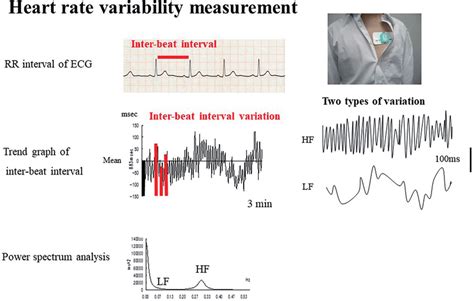 The Methods For Heart Rate Variability Hrv Measurement Rr Intervals