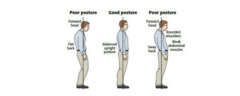 Poor Posture Treatment California Chiropractic Dubai