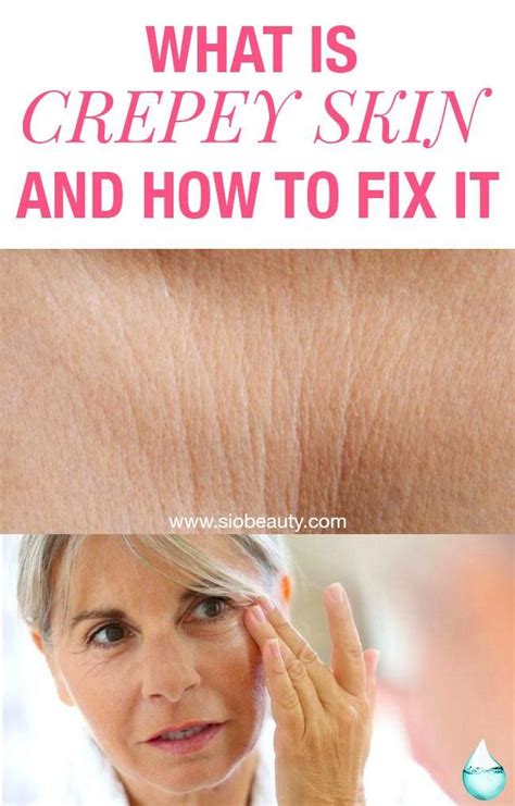 How To Fix Crepey Skin On Neck Jody Schultz News