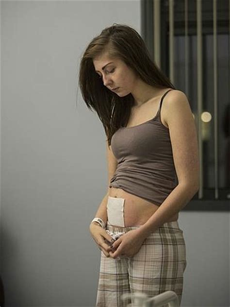 The Teenager Who Looks Nine Months Pregnant When She Eats