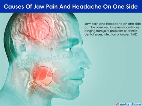 Jaw Pain On One Side Wisdom Teeth Art Of Jawi