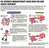 Images of Small Cell Lung Cancer Treatment Immunotherapy