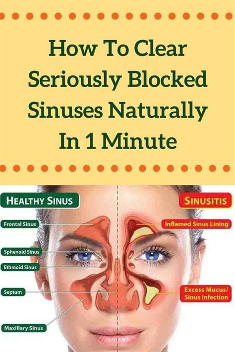 How To Clear Seriously Blocked Sinuses Naturally In 1 Minute With