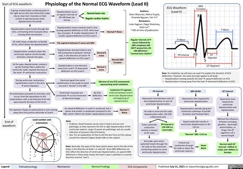 Physiology Of The Normal Ecg Waveform Lead Ii Calgary Guide