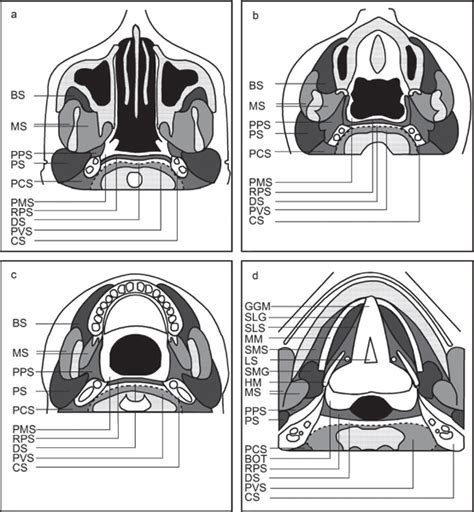 8 Suprahyoid Neck Radiology Key