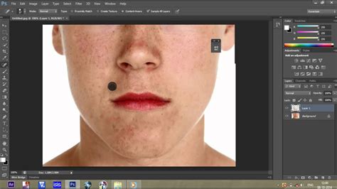 How To Remove Acne Pimples From Faces Using Adobe Photoshop Cs5 Cs6