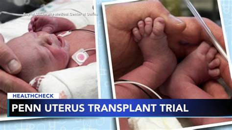 Penn Medicine Successfully Performs Two Uterus Transplants 6abc Philadelphia