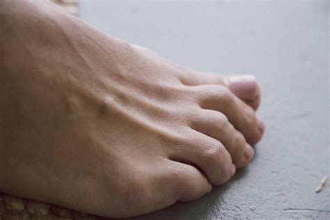 Signs Of Arthritis In Your Feet Foot And Ankle Group
