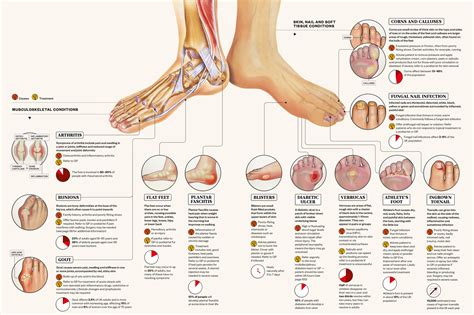 Identifying Common Foot Conditions The Pharmaceutical Journal