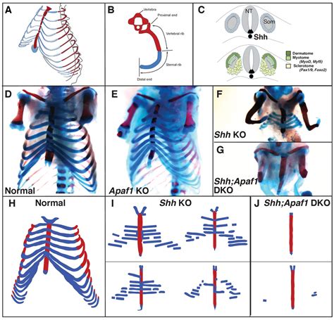A Minimally Sufficient Model For Rib Proximal Distal Patterning Based