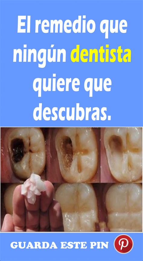 Gu Rdalo Antes De Que Lo Borren Este Es El Remedio Que Ning N Dentista