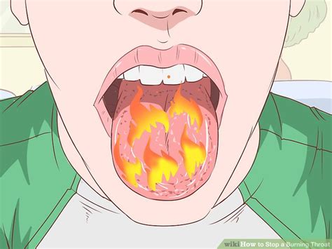 Burning throat or burning sensation in throat can be caused by simply a sore throat or an inflammation of the adenoids. How to Stop a Burning Throat (with Pictures) - wikiHow