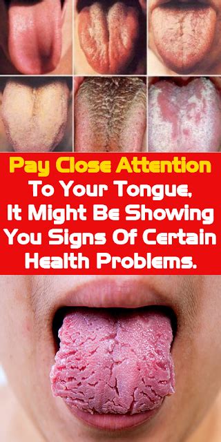 Pay Close Attention To Your Tongue It Might Be Showing You Signs Of Certain Health Problems