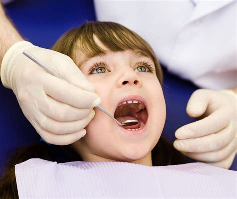 Didyouknow Sealants Are A Great Way To Protect Against Cavities In