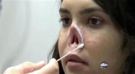 Afghan Girl Bibi Aisha Who Had Nose And Ears Hacked Off Under Taliban