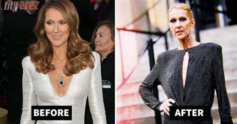 Drastic Celine Dion Weight Loss Transformation Has Fans Worried