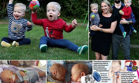 Heart Implant Approved In Britain For First Time Saves Baby S Life Flipboard