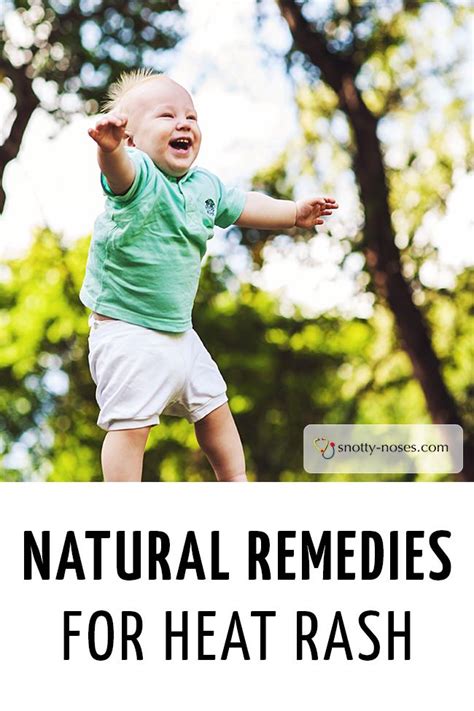 Natural Remedies For Heat Rash In Children