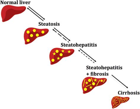 Paediatric Non Alcoholic Fatty Liver Disease A Practical Overview For