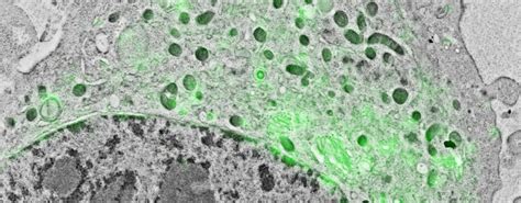 Eukaryotic Cell Under Light Microscope Micropedia
