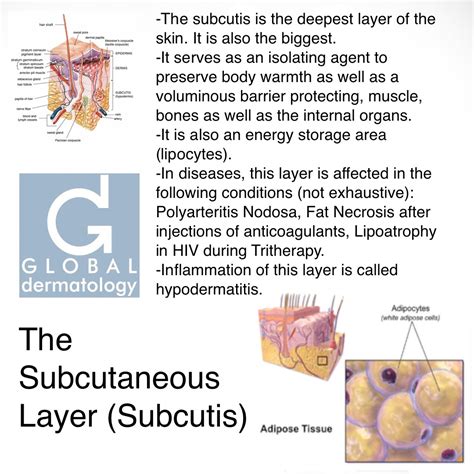 Global Dermatology Subcutaneous Layer Subcutis Instagram