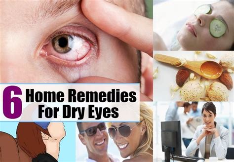 6 Simple Home Remedies For Dry Eyes Dry Eyes Dry Eye Remedies Dry