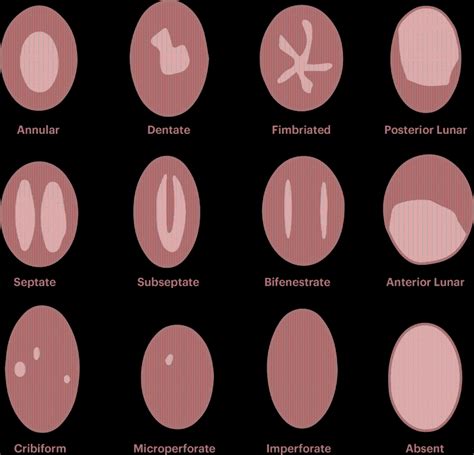 The Different Types Of Hymen Youre Not Popping Anything