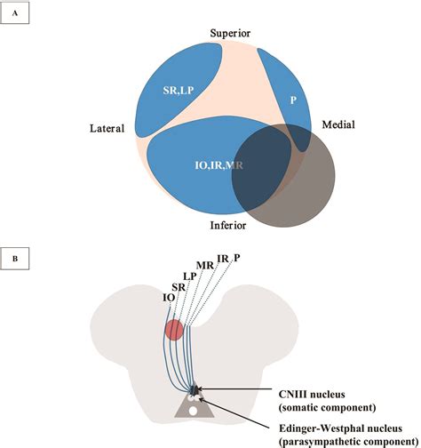 Clinical Reasoning A 74 Year Old Woman Presenting With Monocular