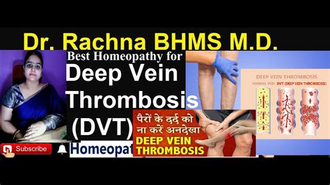 Homeopathy For Deep Vein Thrombosis Dvt Youtube