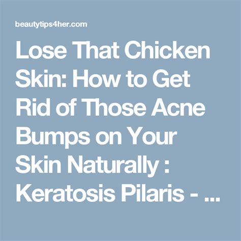 Lose That Chicken Skin How To Get Rid Of Those Acne Bumps On Your Skin