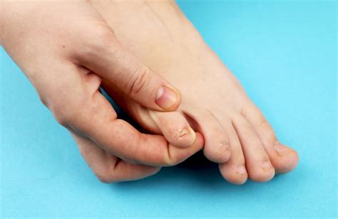 Exploring The Mystery Of The Missing Pinky Toe Cuticle