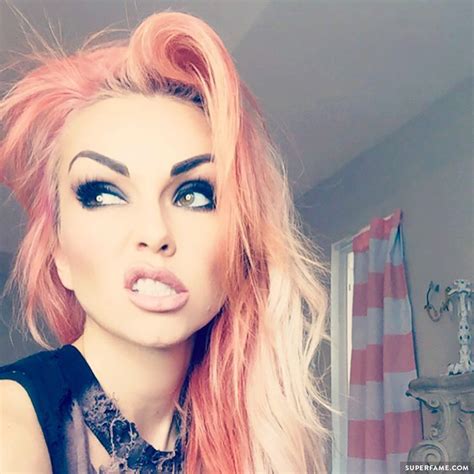 Kandee Johnson Has Emergency Allergic Reaction Gets Shots At Vidcon