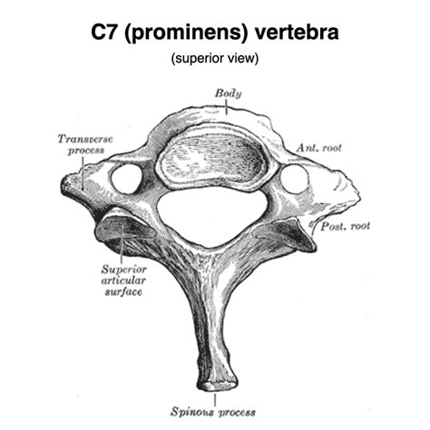 Atypical Cervical Vertebrae Pacs