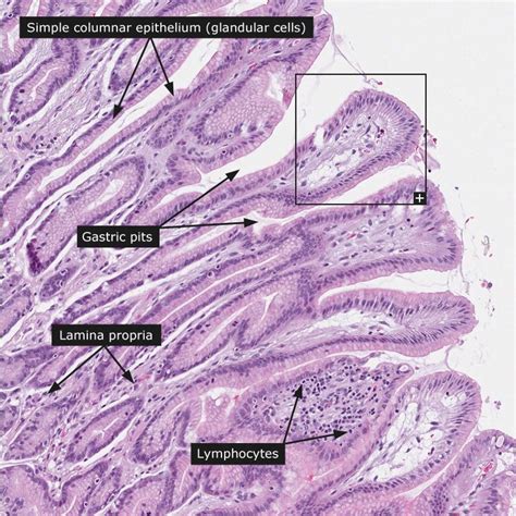 Stomach Histology Gastric Pits Basic Anatomy And Physiology Vet