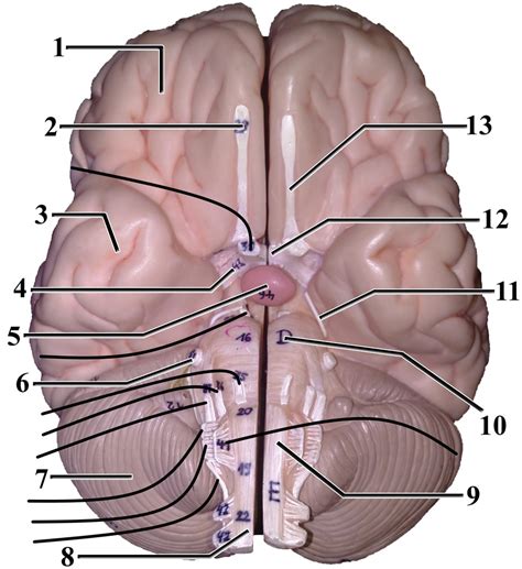 Braincranial Nerves Inferior View Diagram Quizlet