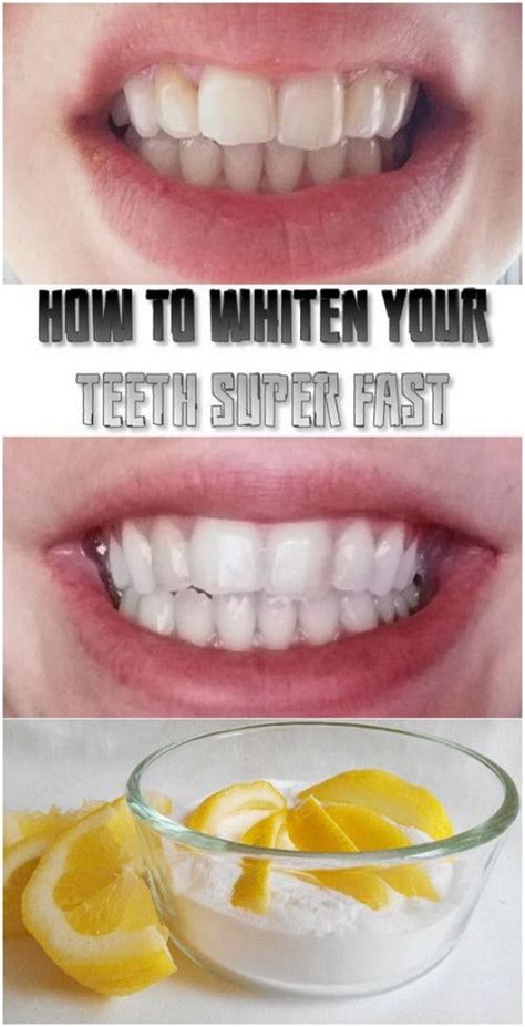 Baking soda is well known for white, crystalline strawberries are well known for whitening teeth, but using it with baking soda is a great option. Effective Homemade Remedies For Teeth Whitening That You ...