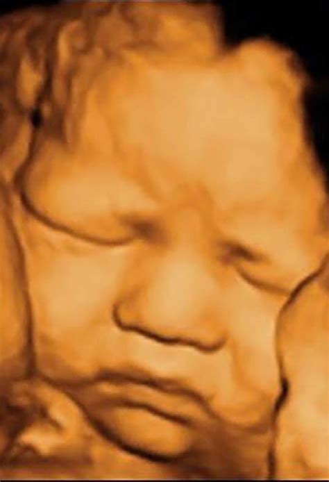 3d Ultrasounds In Reno Womens Health Center Of Reno Nv